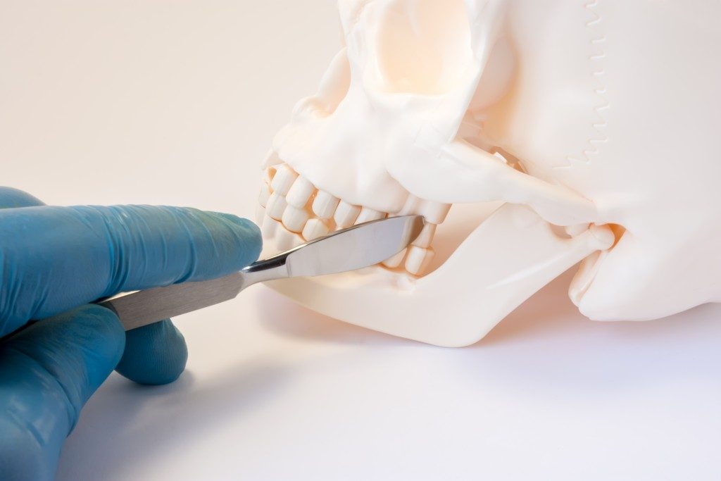doctor pointing at a medical model's jaw