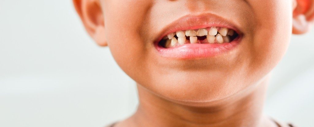 Tooth problems for Children