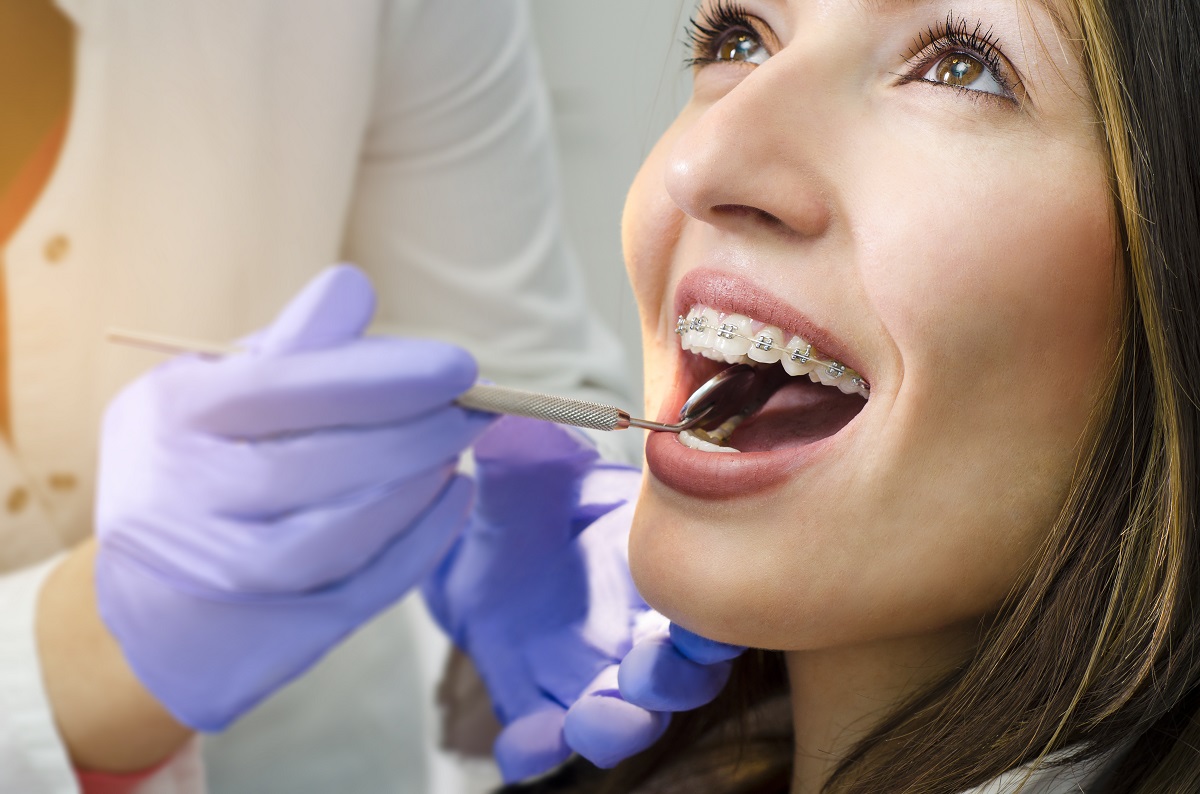 Close up of woman in dental braces check up