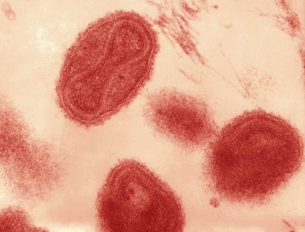 microscopic view of smallpox virus