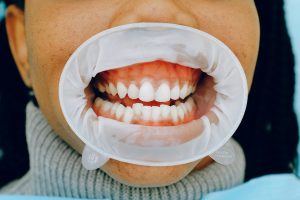 Gleeker Gleeking: How it Works and Why it Happens - Health Research Policy
