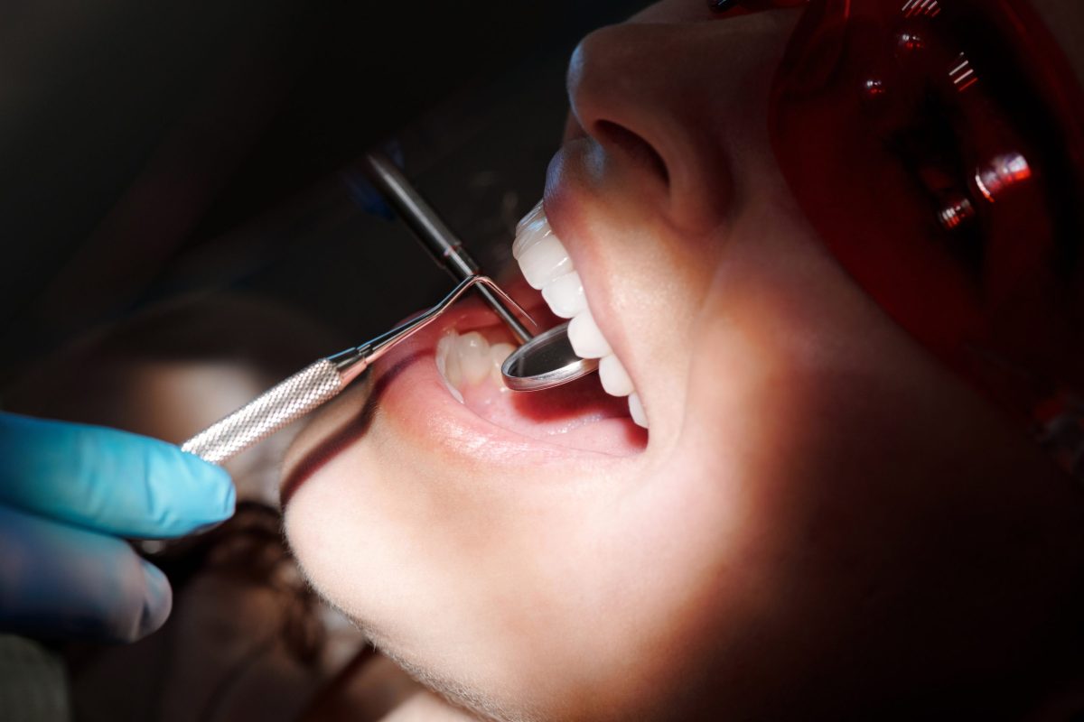 a person on a dental checkup