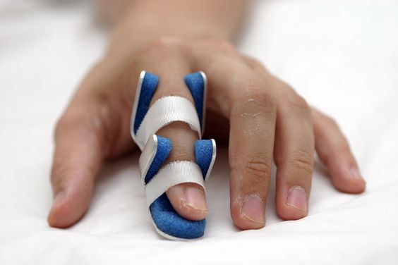 how to finger splint