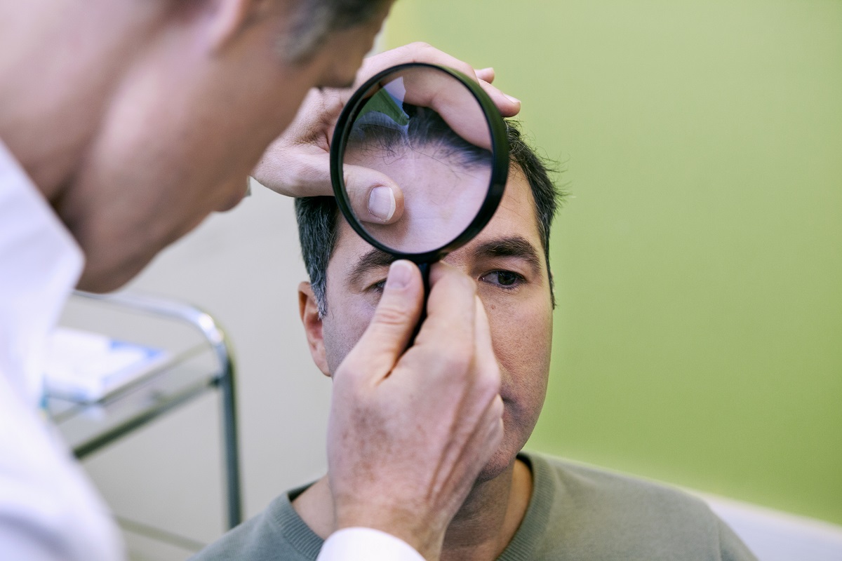 a doctor using magnifying glass to check man's hair