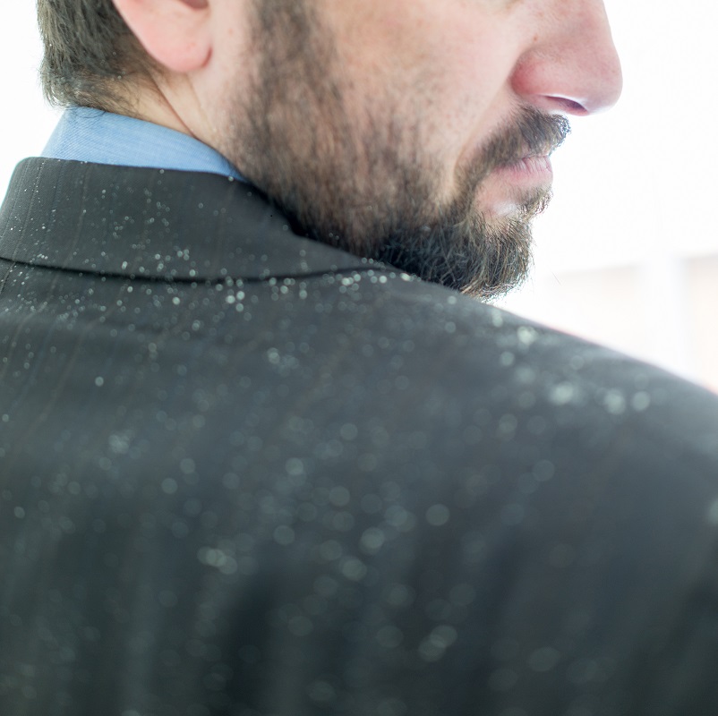man with a dandruff on his shoulder