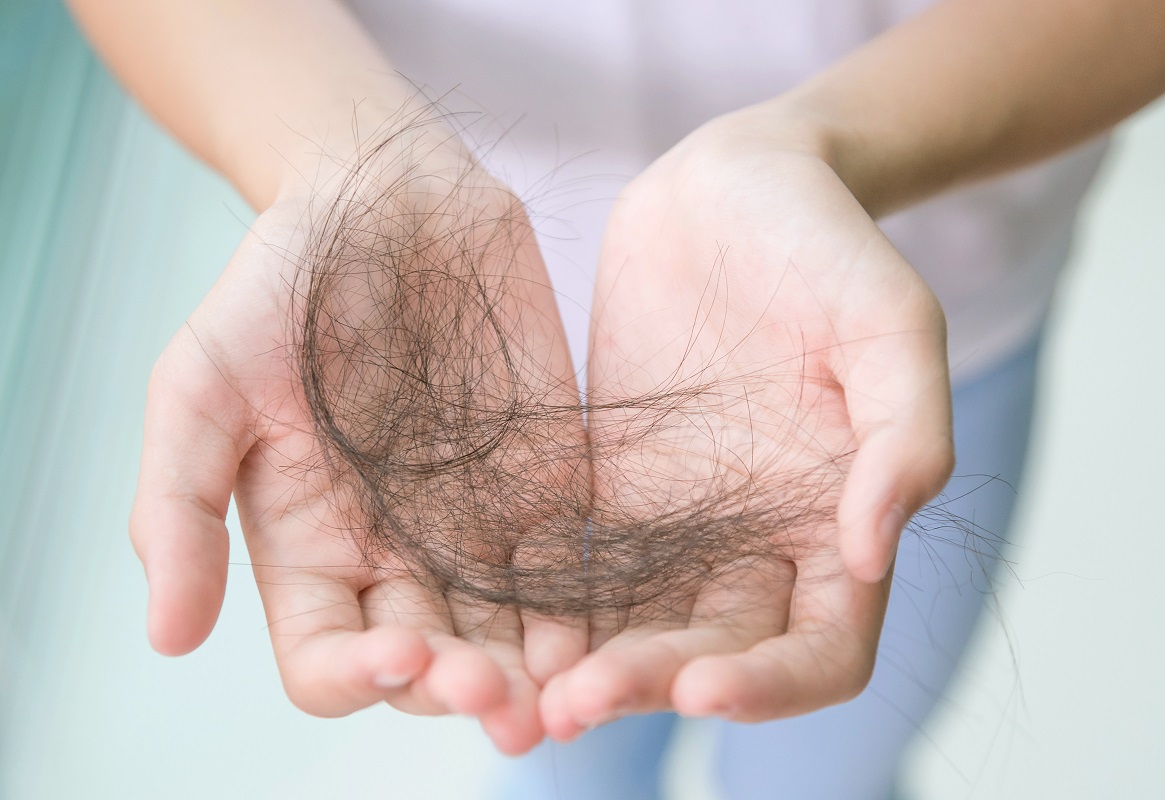 woman showing her lost hair